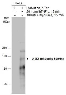 Western Blot: ASK1 [p Ser966] Antibody [NBP3-13306] - Untreated (-) and treated (+) HeLa whole cell extracts (30 ug) were separated by 5% SDS-PAGE, and the membrane was blotted with ASK1 (phospho Ser966) antibody (NBP3-13306) diluted at 1:1000. The HRP-conjugated anti-rabbit IgG antibody (NBP2-19301) was used to detect the primary antibody.